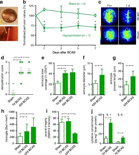 Mouse Anti Smi Covance Bioz