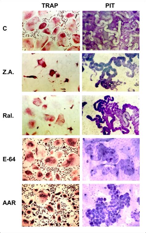 The Effects Of Several Bone Resorption Inhibitors On Human Osteoclast Download Scientific