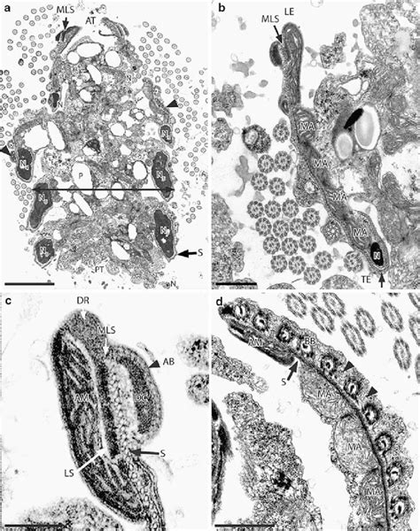 Transmission Electron Micrographs TEM Of Pre Released Sperm Cells Of