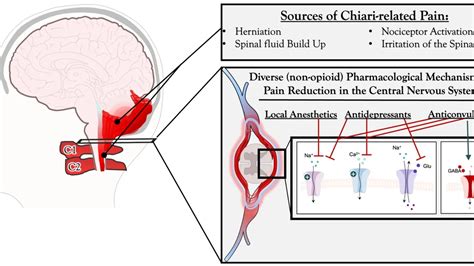 The Chiari Surgical Success Scale A New Measure For Chiari Malformation Treatment Outcomes