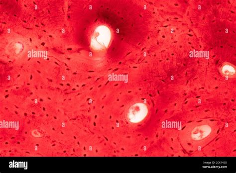 Tejido oseo histologia fotografías e imágenes de alta resolución - Alamy