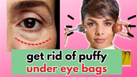 How To Get Rid Of The Bags Under Your Eyes Youtube