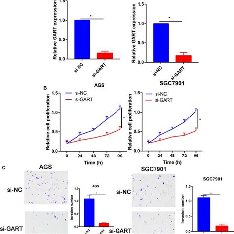 Knockdown Of Gart Inhibited Gc Cells Proliferation Migration And