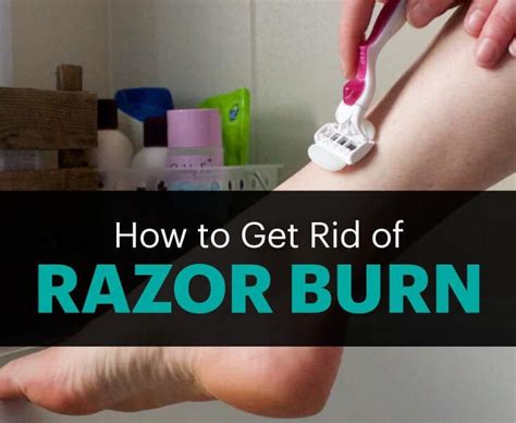 Quick Ways To Get Rid Of Razor Burn