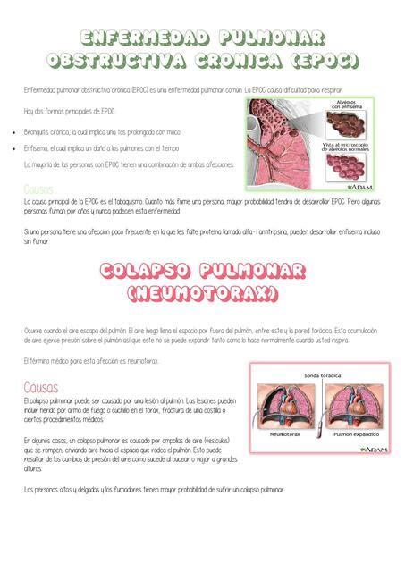 Enfermedad Pulmonar Obstructiva Cr Nica Epoc Yoongi The Life Udocz