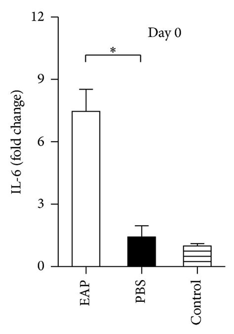 The Expression Of Il 6 Tnf α And Ifn γ In Vivo The Expression