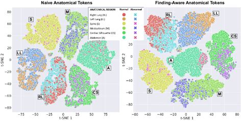 T SNE Visualisation Of Normal And Abnormal Embeddings For A Subset Of