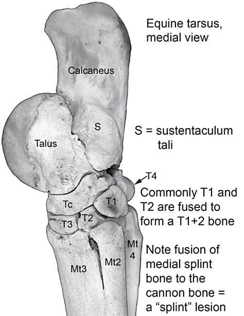 Tarsus Labeled