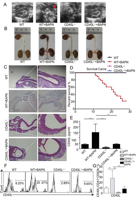 CD40L Promotes Development Of Acute Aortic Dissection Via Induction Of