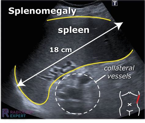 Abdominal ultrasound