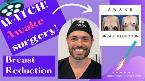 Awake Breast Reduction Plastic Surgery Operation Longterm Results