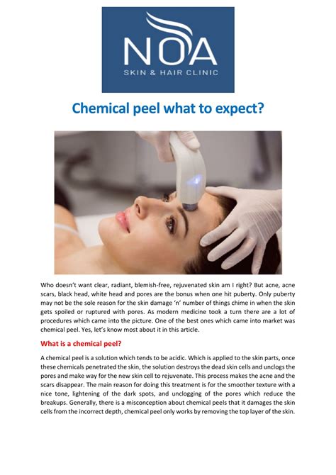 PPT Chemical Peel What To Expect PowerPoint Presentation Free