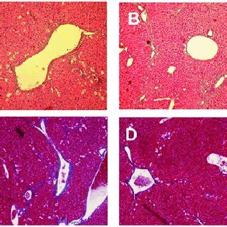 Photomicrographs Of Liver Tissue In Ccl Csa Mice Stained With He A