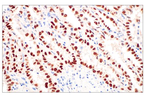 Thyroid Transcription Factor 1 TTF 1 SPT24 Mouse MAb Cell