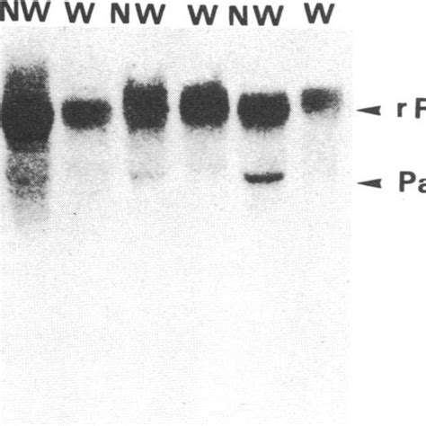 RNA Gel Blot Hybridization Of 32P Labeled Nicktranslated Patatin CDNA