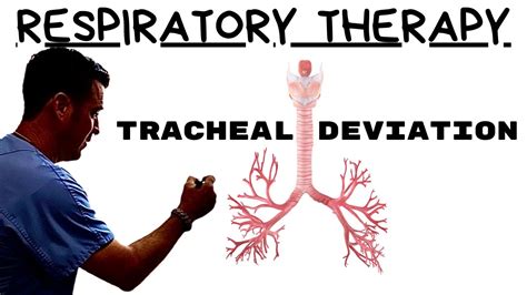 Respiratory Therapist Tracheal Deviation Youtube