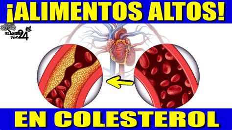 Para De Comer Estos Alimentos Que Suben El Colesterol Y Conoce Los