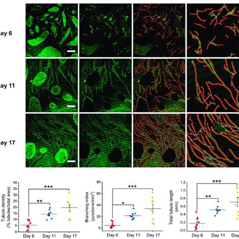 Analysis Of Angiogenesis In Human Umbilical Vein Endothelial Cells