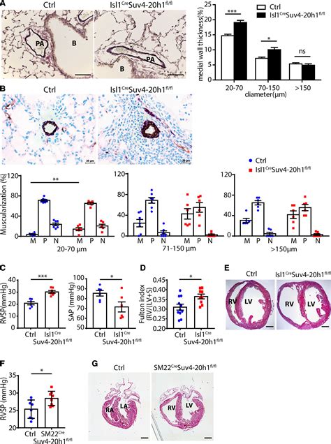 Epigenetic Regulation By Suv4 20h1 In Cardiopulmonary Progenitor Cells