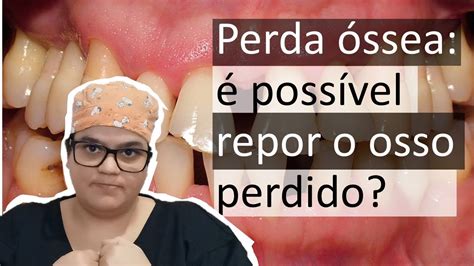 Como Recuperar O Osso Perdido Na Perda Ssea Periodontite Dra