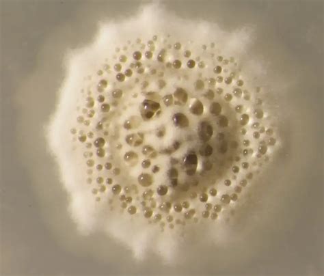 Actinomycetes Definition Classificationcharacteristics And Culture