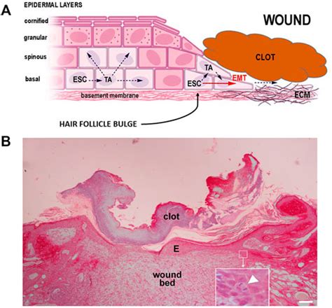 Frontiers The Epidermis In Microgravity And Unloading Conditions And