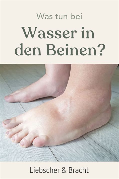 Du leidest unter schweren und geschwollenen Beinen Erfahre mehr über