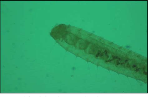 Figure 1 from Reports on Aquatic Oligochaetes (Naididae) In Paddy ...