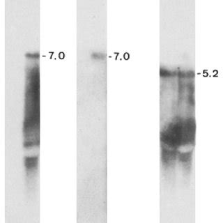 A And B Northern Blot Analysis Of Poly A Rna Extracted From Flies