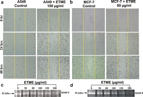 Wound Healing Activity Of Untreated And Treated A549 And MCF 7 Cells