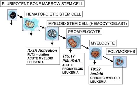 Gene Translocation And Stages Of Maturation Arrest Of Three Human