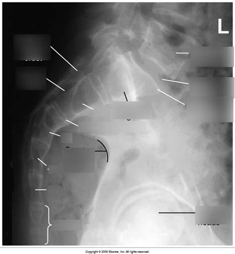 Left Lateral Sacrum Coccyx Anatomy Labelled Diagram Quizlet