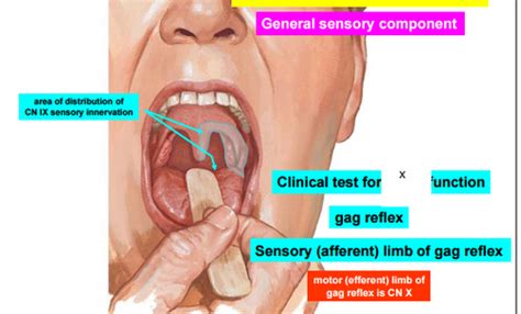 Gag Reflex Test