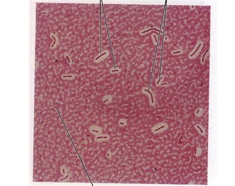 Gram Staining Flashcards Quizlet