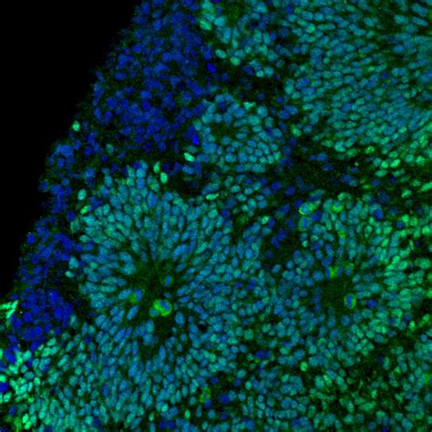 Pax6 Antibody 67529 1 Ig Proteintech