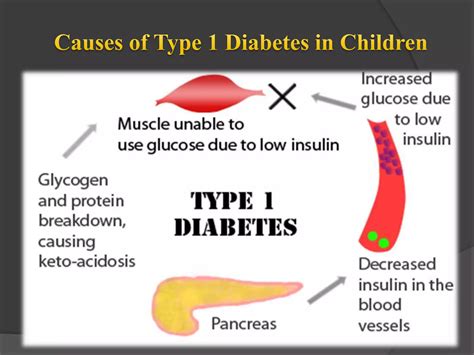 Type 1 Diabetes In Children Ppt