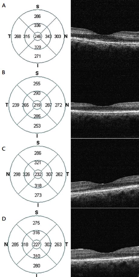 Retina Today Anemic Retinopathy Case Reports And Disease Features