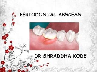 Periodontal abscess | PPT