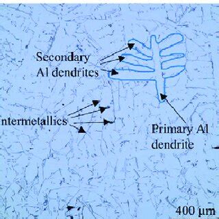 Typical Microstructure Of A Cast Hypoeutectic Al Si Alloy After