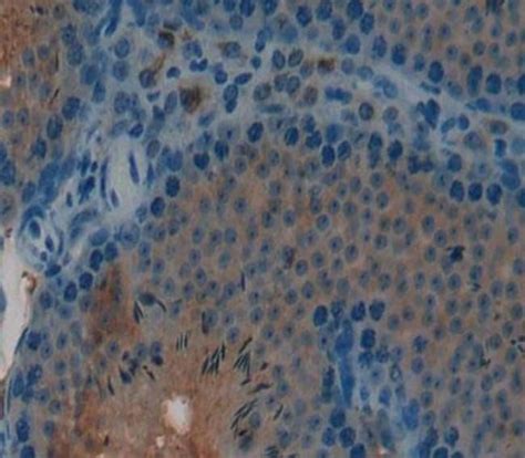 hCG beta 1 Polyclonal Antibody Invitrogen 20 μL Unconjugated