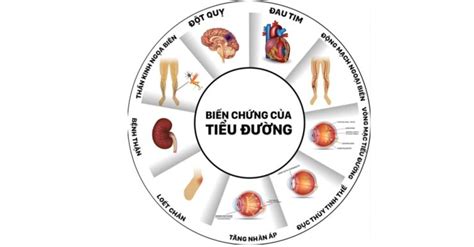 Tổng Quan Bệnh đái Tháo đường Nguyên Nhân Dấu Hiệu Biến Chứng Và