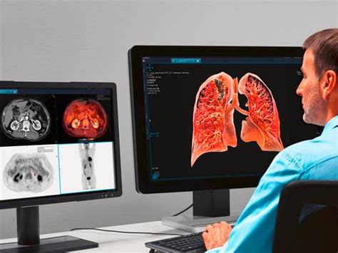 Imaging Software Siemens Healthineers