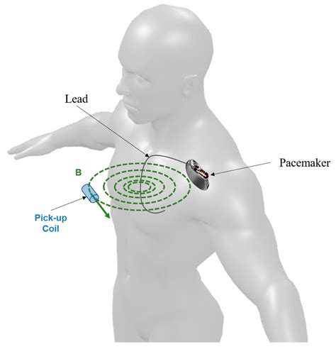 Sensors Free Full Text A Contactless Sensor For Pacemaker Pulse