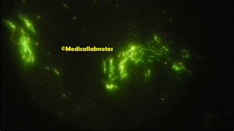 Auramine Phenol Stain Introduction Principle