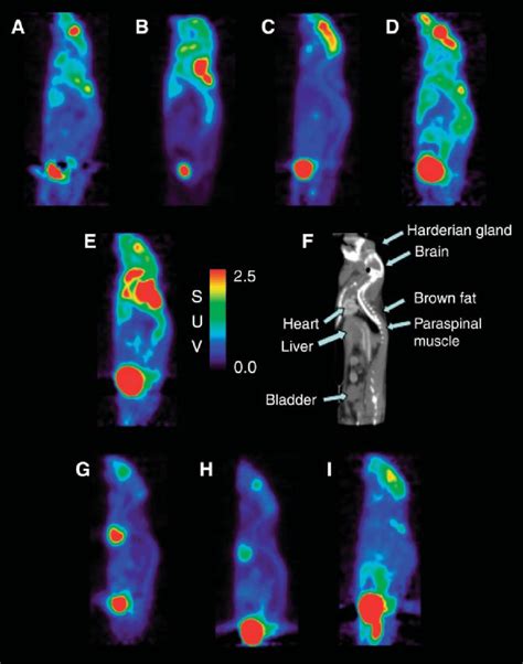 Typical Examples Of Biodistribution Of F Fdg Under Various