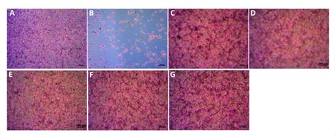 Mg63 Cells Stained By Hand E After Incubation With Sample Extracts At A