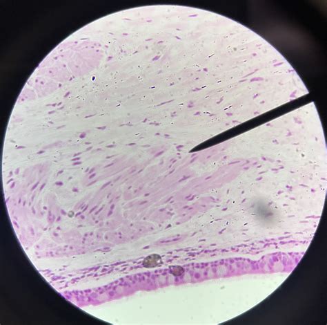 Trachea Histology Diagram Quizlet