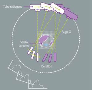 Principi Di Funzionamento Della Tomografia Computerizzata Tc Bald