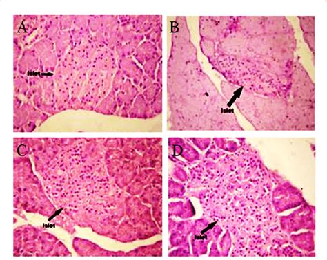 Histopathology Of Pancreas Showing Variation In Islet Number Size And