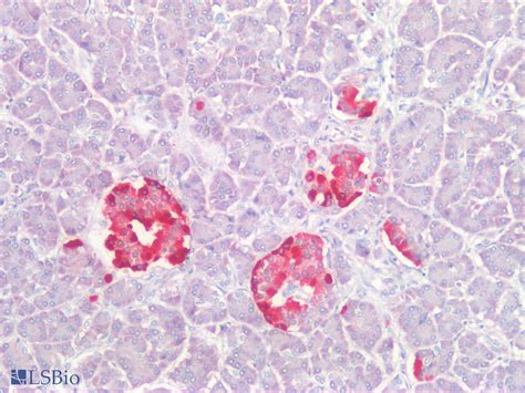 PathPlus CHGA Chromogranin A Polyclonal Antibody Rabbit IHC LSBio